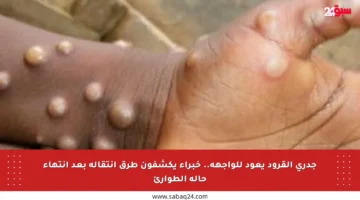جدري القرود يعود للواجهة.. خبراء يكشفون طرق انتقاله بعد انتهاء حالة الطوارئ